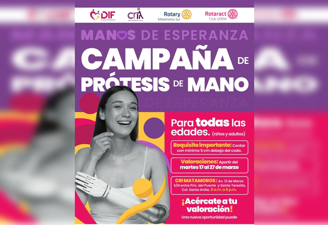 DIF Matamoros lanza campaña de prótesis de mano gratuitas: Una oportunidad para transformar vidas